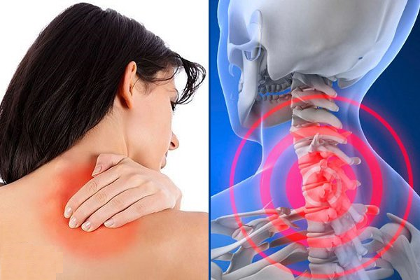 Phòng tránh đau mỏi vai gáy, tê bì chân tay